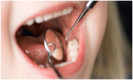 عيادات أسنان تتحوّل إلى بؤر لداء التهاب الكبد الفيروسي