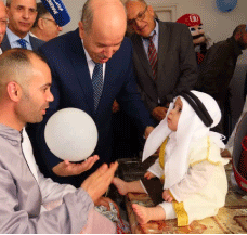 سايحي يؤكد التكفل بأطفال تعرضوا لمضاعفات بباتنة: إجـراء عمليــات الختـــان خــــــارج المؤسســــــات الصحيـــــة ممنــــــوع
