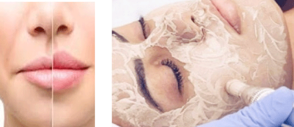 تقنيات تجميل يحذر الأطباء من إجرائها بصالونات الحلاقة 