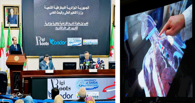 سيتم استعمالها كأداة تعليمية لطلبة الطب: صنع أول طاولة تشريح افتراضية ابتكارية جزائرية للتدريب على علــم التشريح